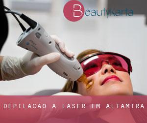 Depilação a laser em Altamira
