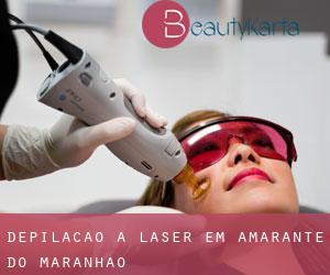 Depilação a laser em Amarante do Maranhão