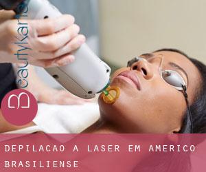 Depilação a laser em Américo Brasiliense