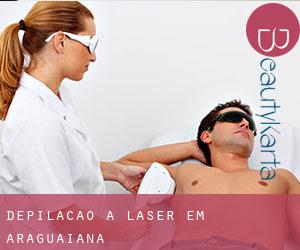 Depilação a laser em Araguaiana