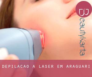 Depilação a laser em Araguari