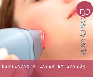 Depilação a laser em Bayeux