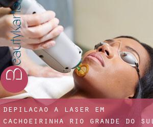 Depilação a laser em Cachoeirinha (Rio Grande do Sul)