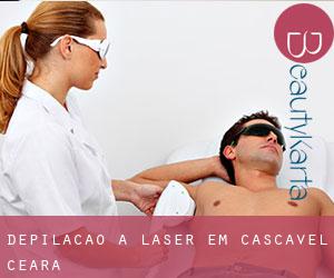 Depilação a laser em Cascavel (Ceará)