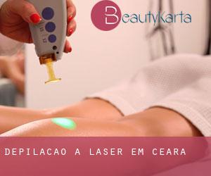 Depilação a laser em Ceará