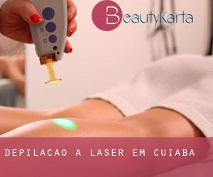 Depilação a laser em Cuiabá