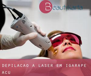 Depilação a laser em Igarapé-Açu