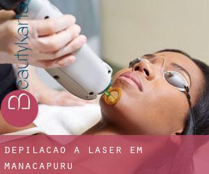 Depilação a laser em Manacapuru