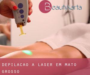 Depilação a laser em Mato Grosso