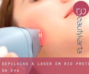 Depilação a laser em Rio Preto da Eva