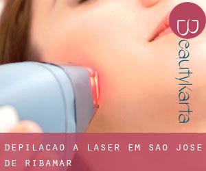 Depilação a laser em São José de Ribamar