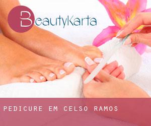 Pedicure em Celso Ramos